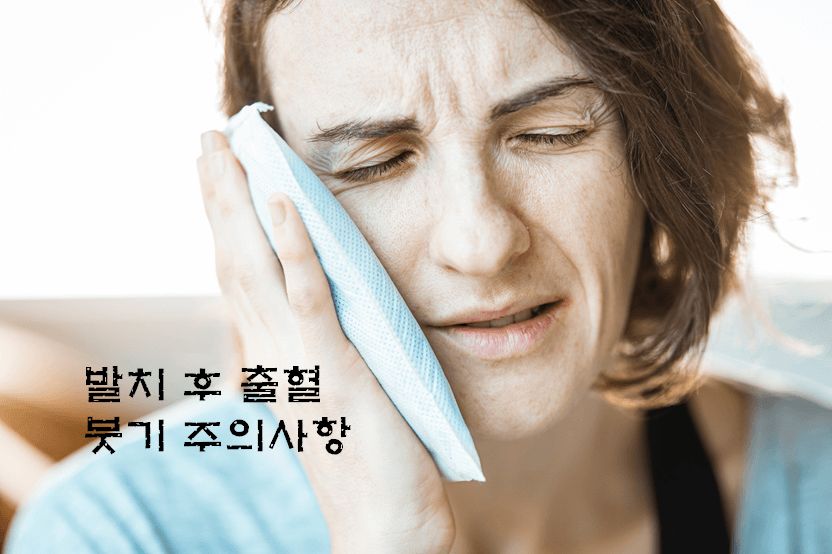 발치 후 출혈 붓기