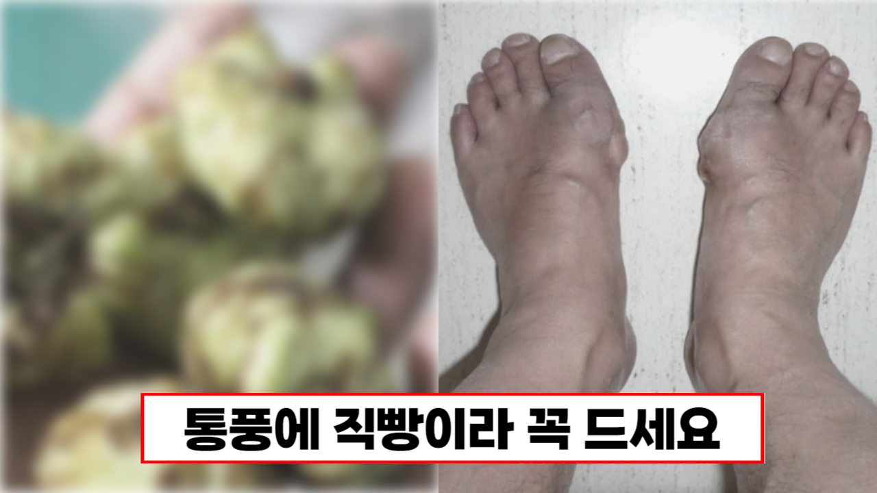 통풍있는 분들은 마트에 이것 보이면 무조건 사세요! 통풍에 직빵입니다!