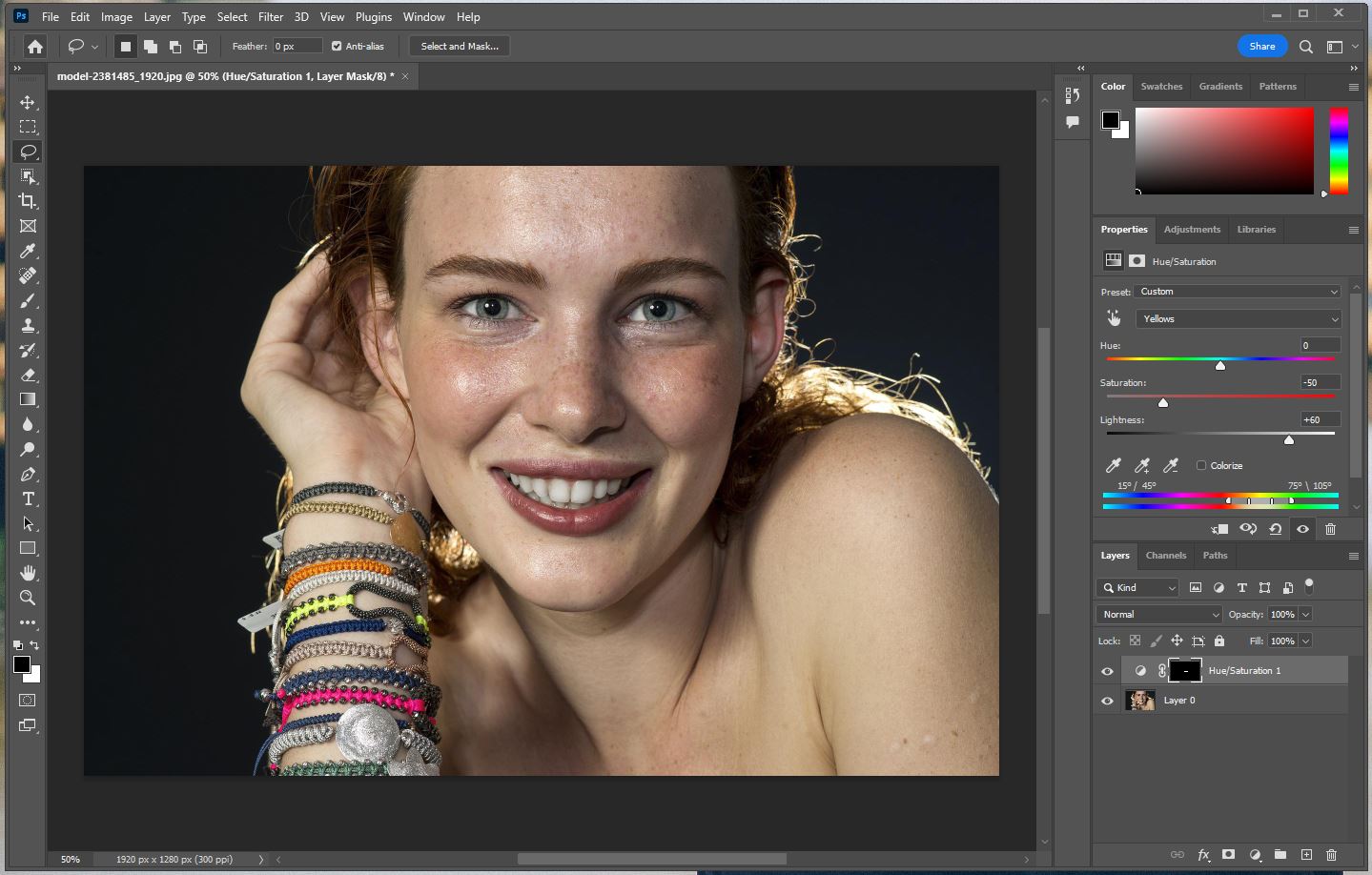 치아 광도 변경