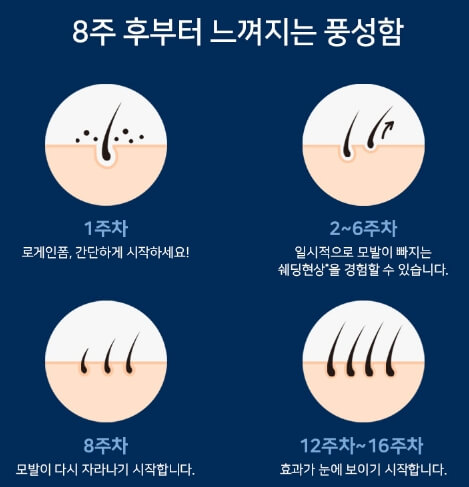 바르는-탈모약-미녹시딜-로게인폼