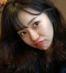 홍지윤 성형 전후