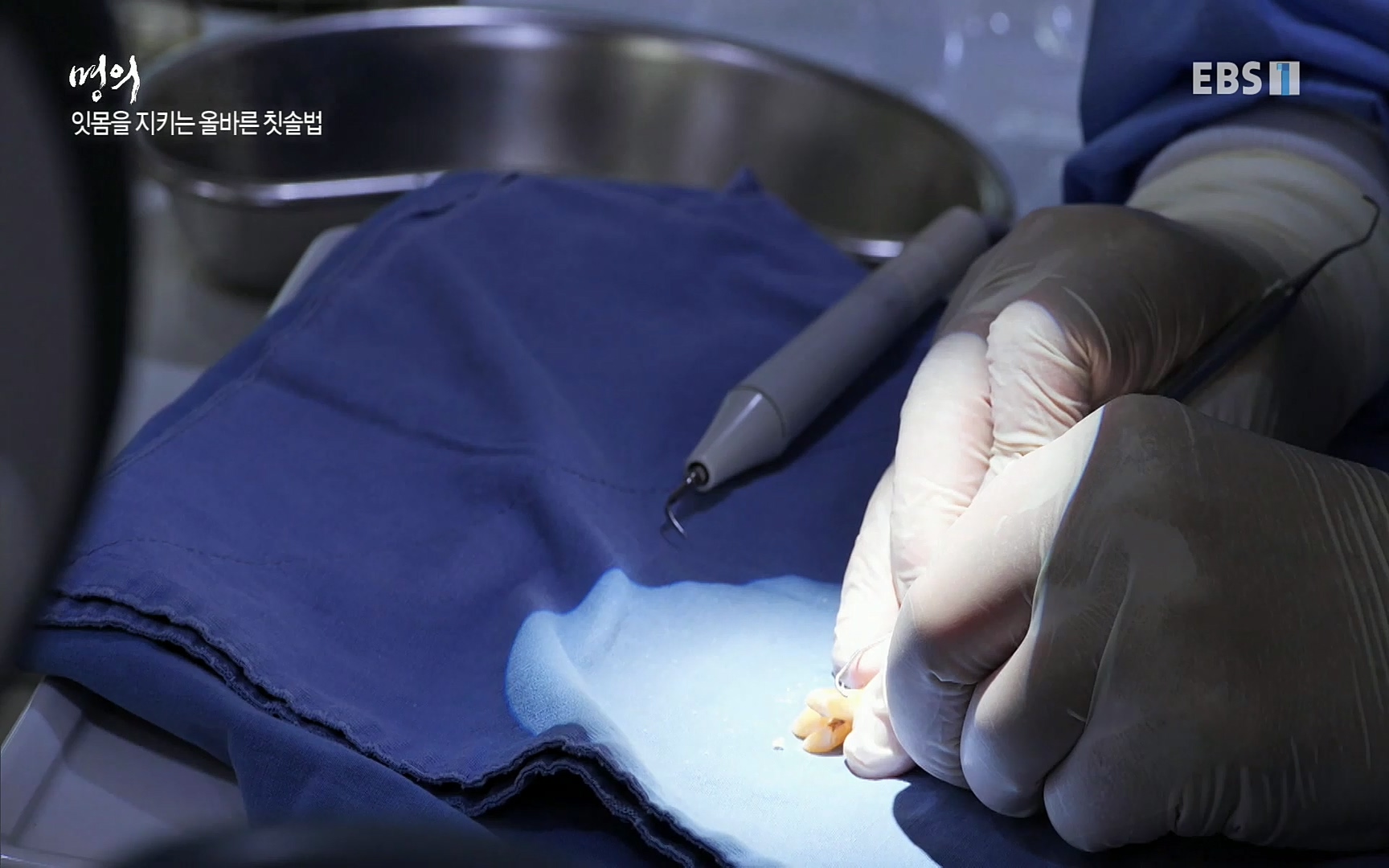 EBS 명의 헬스케어 - TV - 교육의 중심 EBS치주염이 코로나로 소홀해진 구강관리가 치아를 더 망가트리고 위험하게 만들며, 증상이 없기 때문에 특히 더 조심하고 치은염 단계에서 진행되지 않도록 예방해야한다 정의원 교수님과 치_20220505_151725.147.jpg