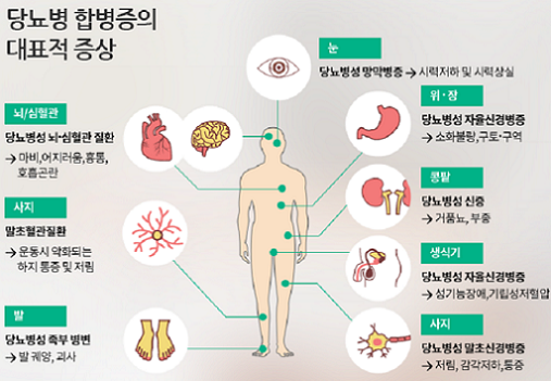 당뇨병 - 일반 - 합병증 - 증상 - 사진