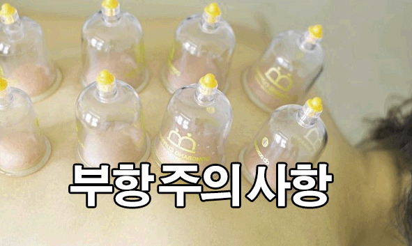  부항 효능 : 부황 주의사항