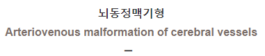  뇌동정맥기형 [Arteriovenous malformation of cerebral vessels]