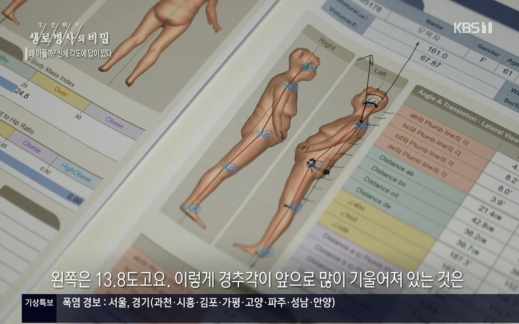 생로병사의 비밀.E825.220706p.H264-F1RST.mp4_20220707_185754.665.jpg