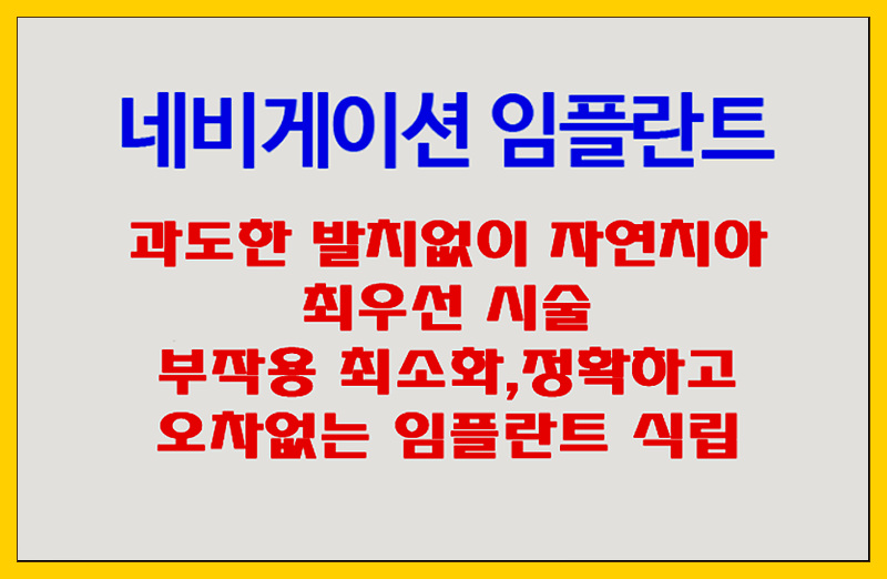  네비게이션 임플란트 시술 장점 알아볼게요