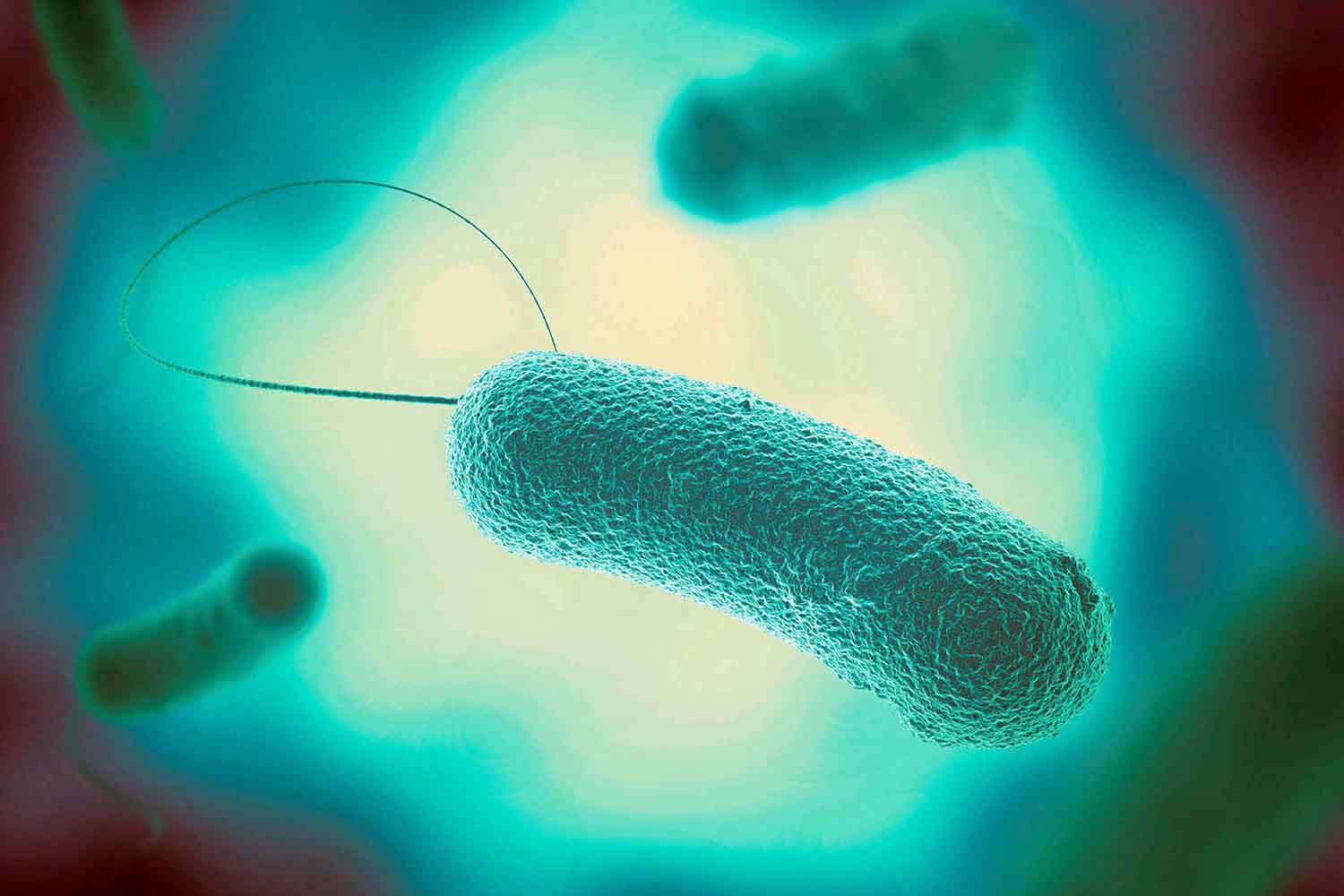 legionella