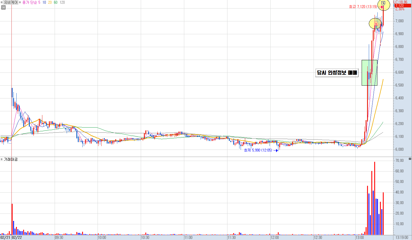 유비케어 분봉 차트 1)