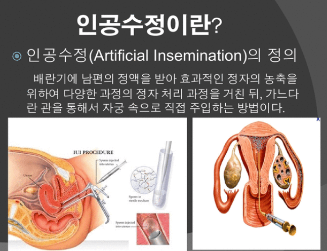 시험관