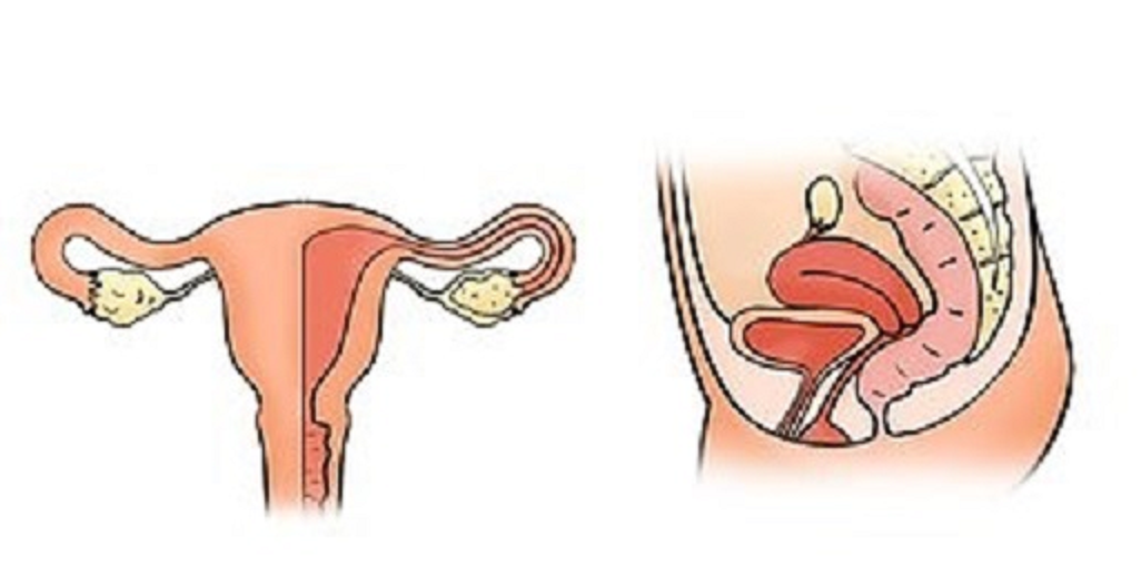  자궁암 왜 생기는가? 자궁경부암이란? 자궁암.