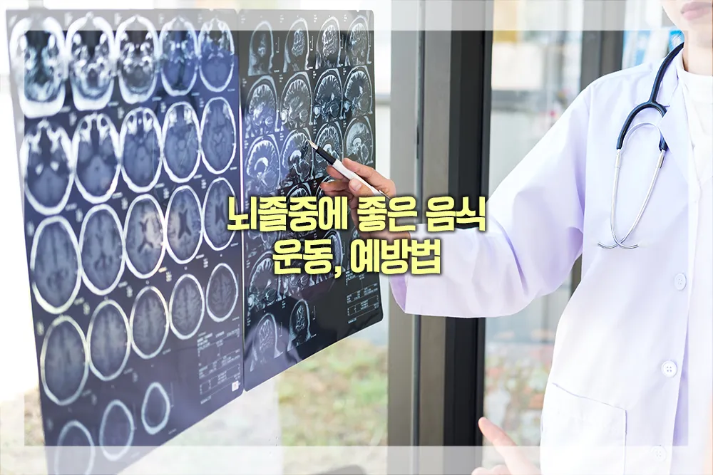 뇌졸중에 좋은 음식 운동 예방법