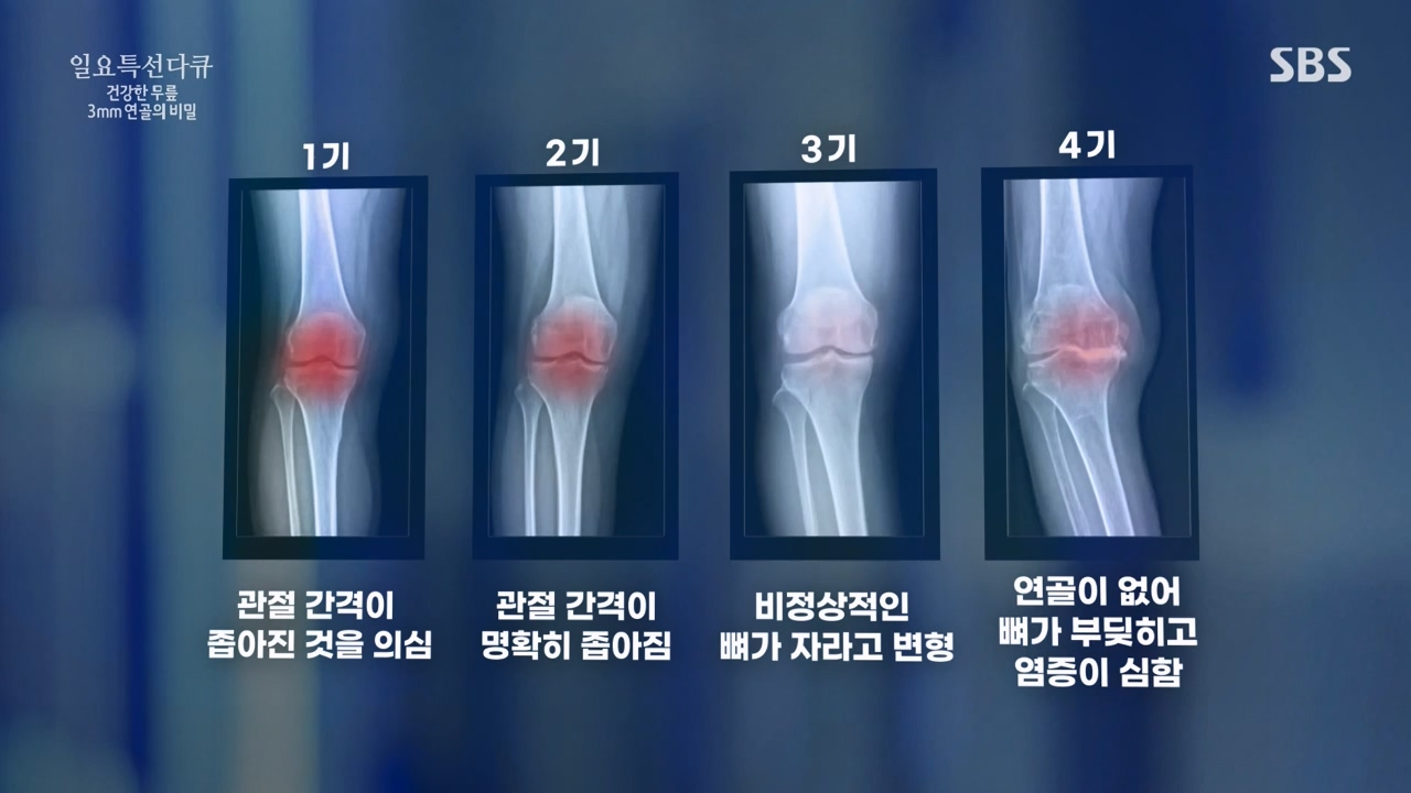일요특선 다큐멘터리.E341.240318p-NEXT.mp4_20240317_190258.932.jpg
