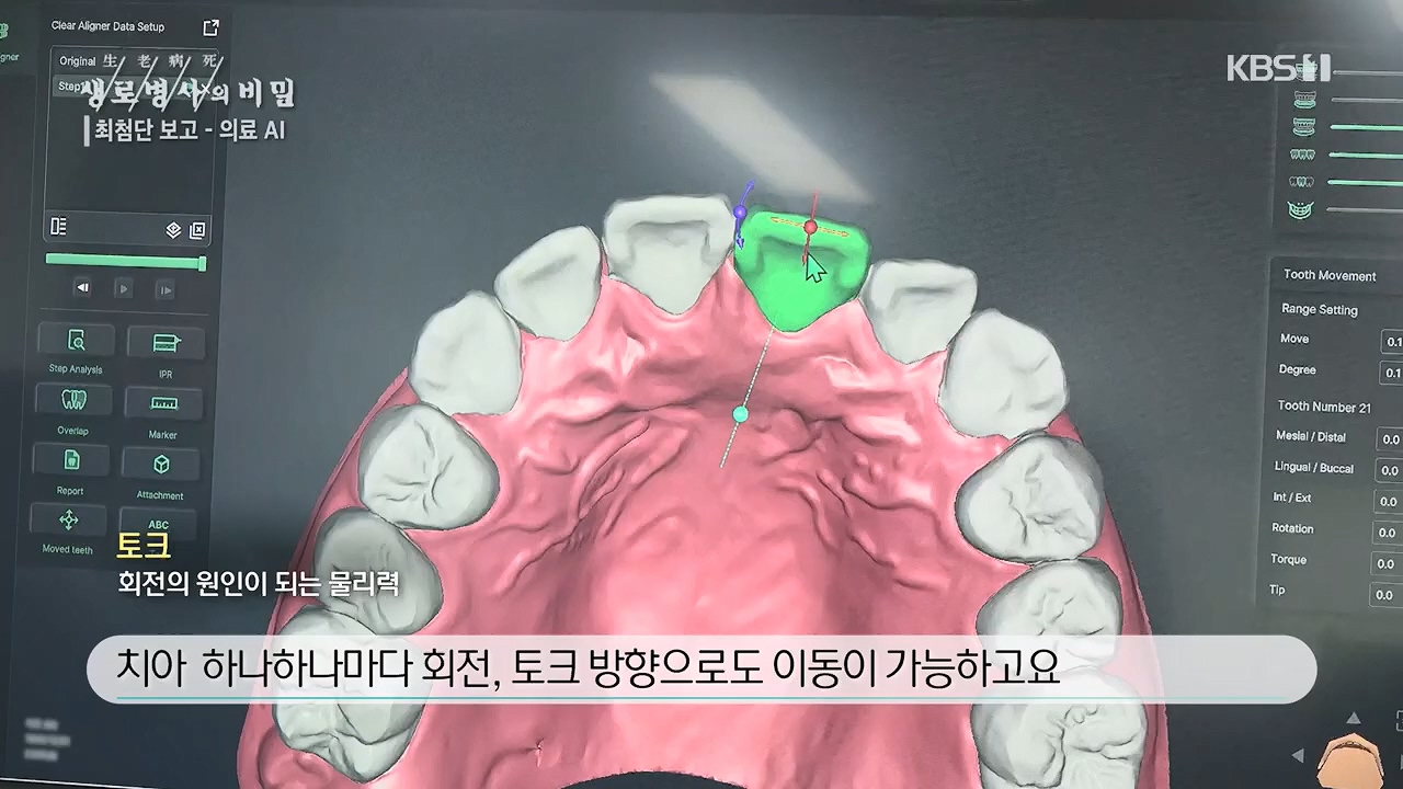 생로병사의 비밀.E869.230518p.H264-F1RST.mp4_20230518_200716.066.jpg