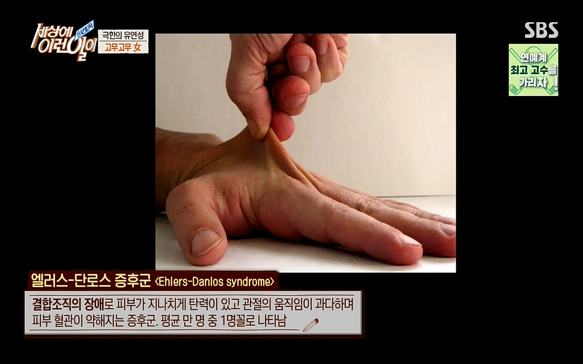 순간포착 세상에 이런일이.E1195.220831p-NEXT.mp4_20220831_201224.397.jpg