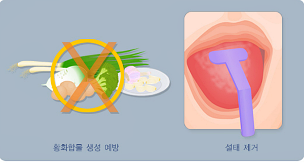 입냄새 원인질환치료_이미지: 질병관리청