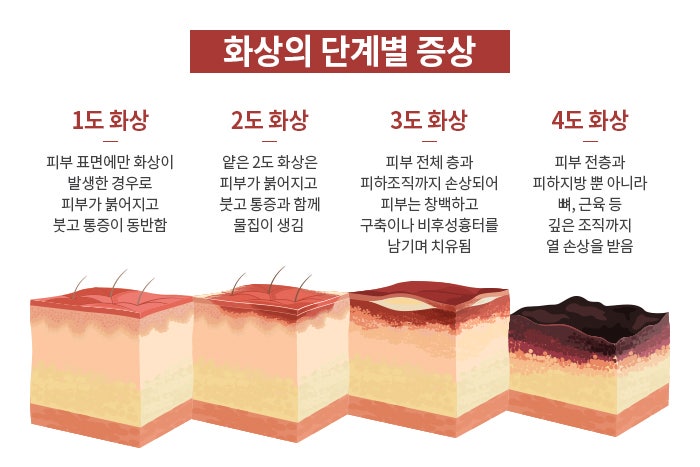 심재성 이미지