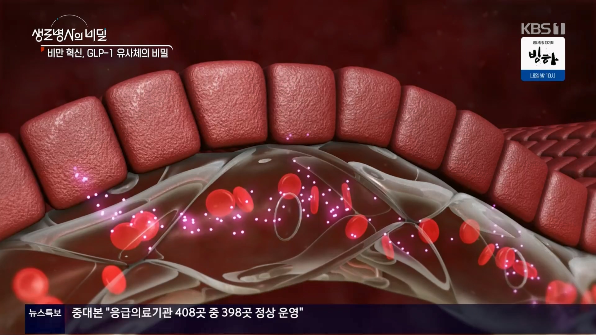 생로병사의 비밀.E901.240313p.H264-F1RST.mp4_20240314_202401.583.jpg