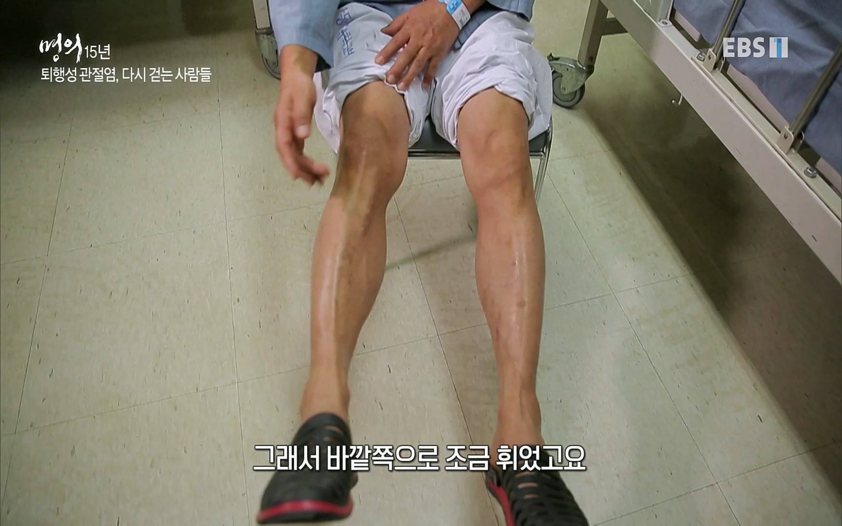 EBS 명의 헬스케어 - TV - 교육의 중심 EBS명의 15년 - 퇴행성관절염, 다시 걷는 사람들.mp4_20220803_212704.055.jpg