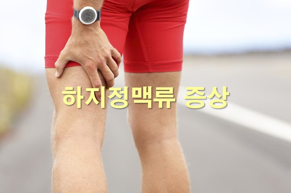  하지정맥류 증상과 하지정맥류 수술비용