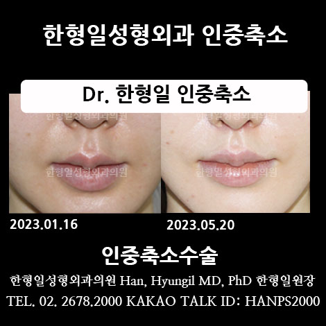 인중 이미지