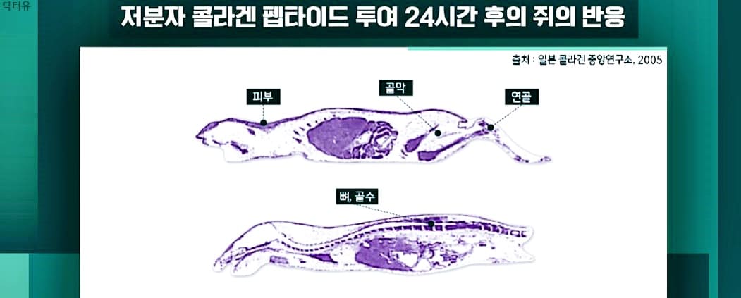 에버콜라겐 실제후기