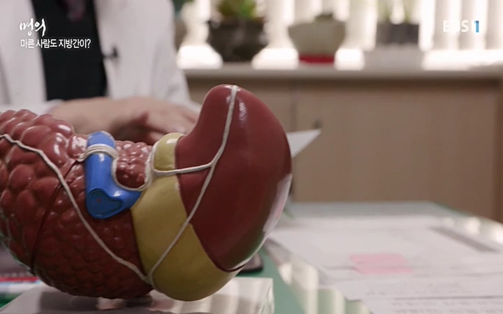 명의_ 제 764회 〈지방간의 경고 1부, 살찐 간이 위험하다〉_ 220429.avi_20220503_193651.400.jpg