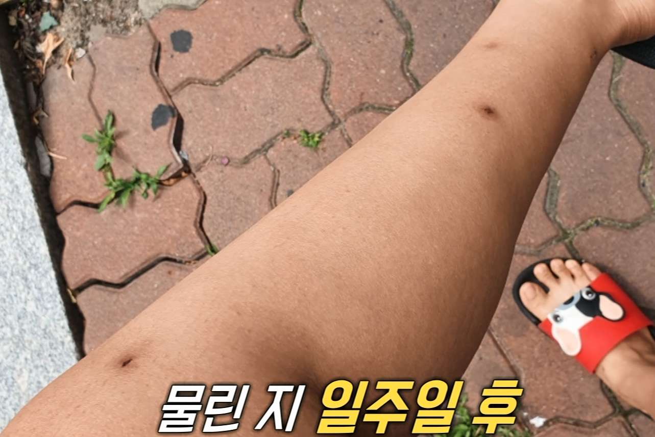 모기보다 무서운 흡혈 파리, 먹파리(블랙플라이)에 대하여