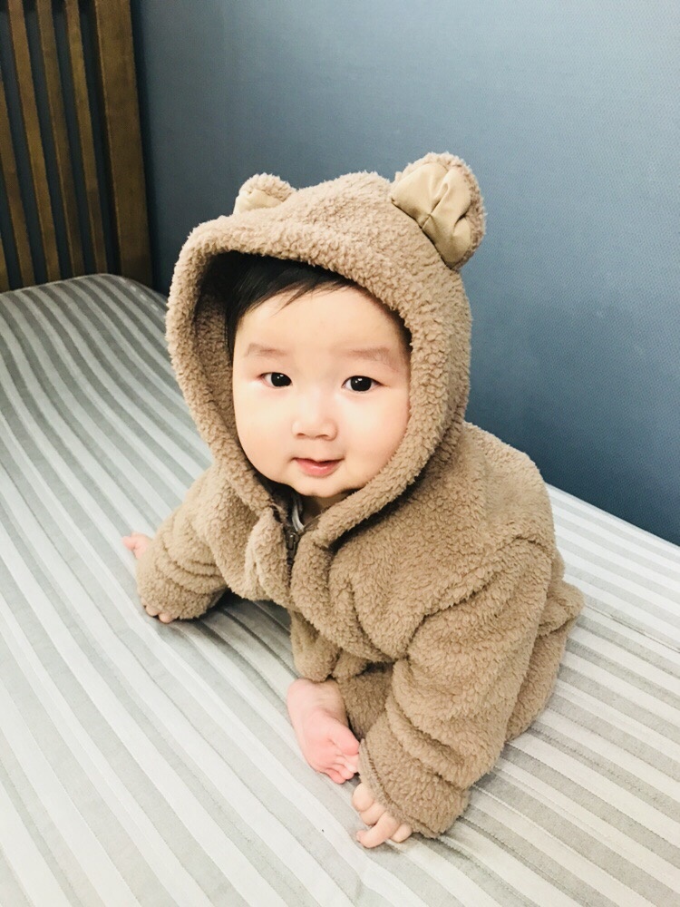 치료 너무 걱정하지 마세요 신생아 황달 원인과 수치,