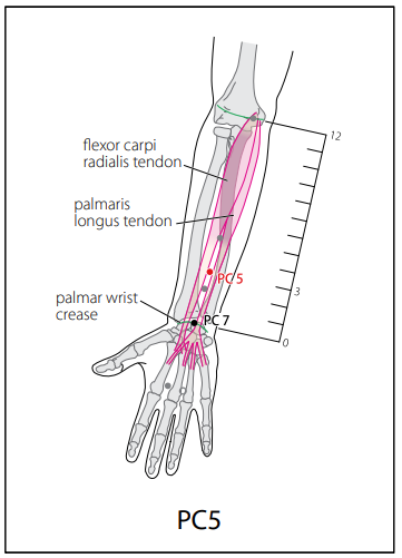 수궐음심포경(PC) > PC5 간사 (間使) 1