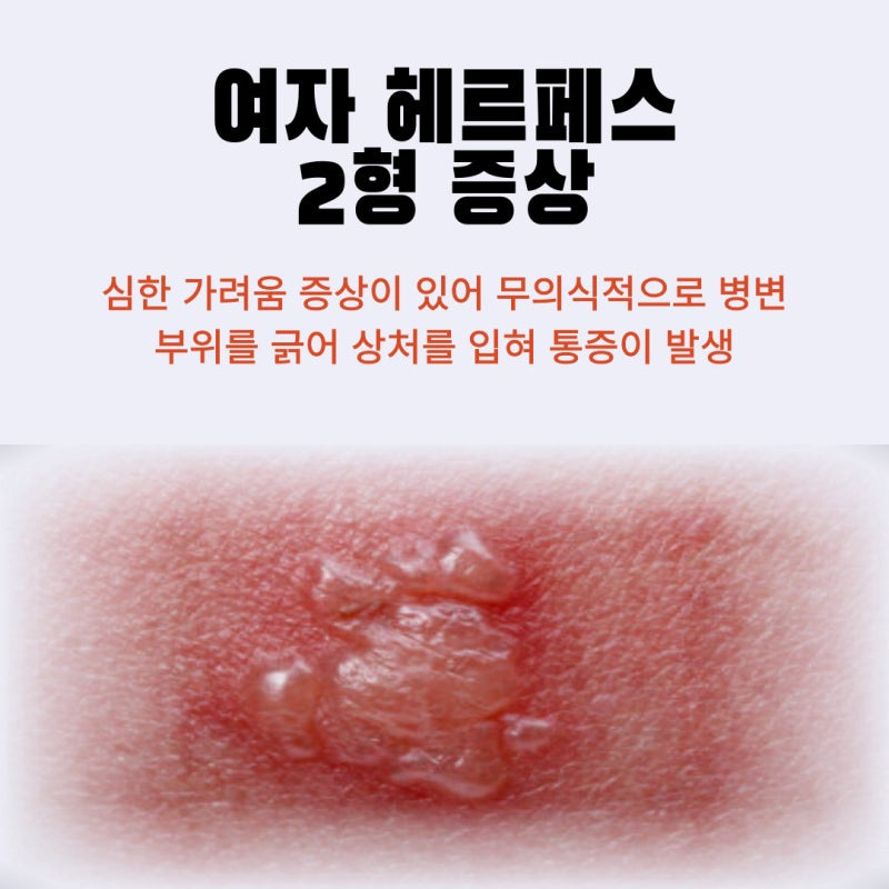헤르페스 2형 원인 증상 03