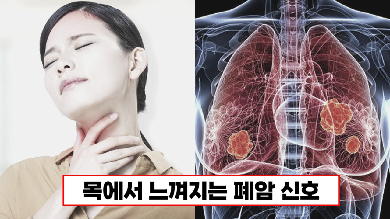 “이미 폐가 60% 이상 망가졌다고..” 폐암 발병시 목에 나타나는 최악의 증상