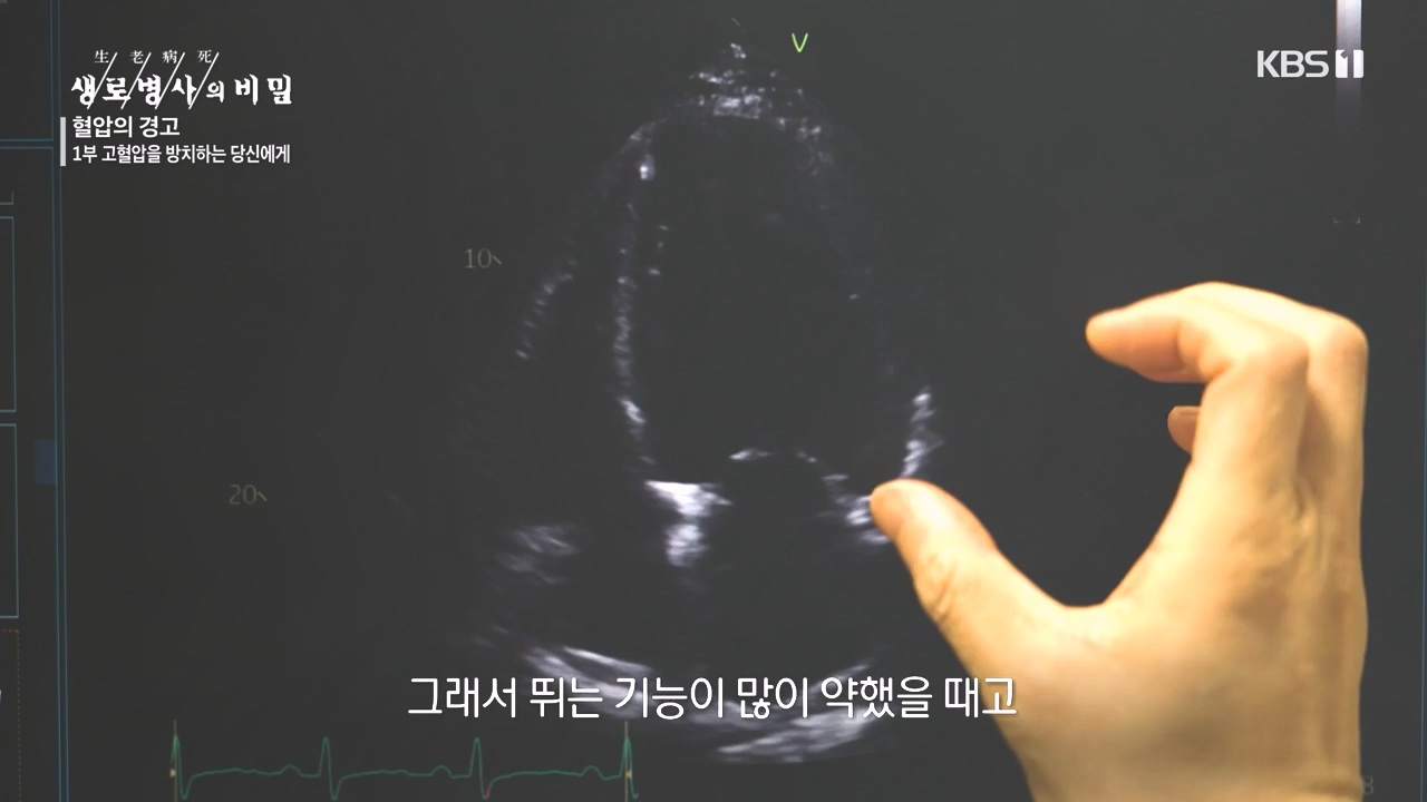 생로병사의 비밀.E887.231026p-NEXT.mp4_20231026_203156.165.jpg