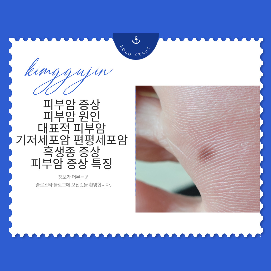 피부암 관련 증상 사진