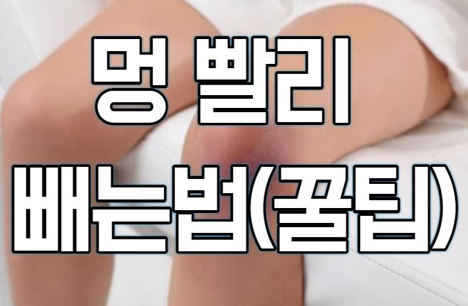  멍 빨리 빼는법(냉찜질? 온찜질?)