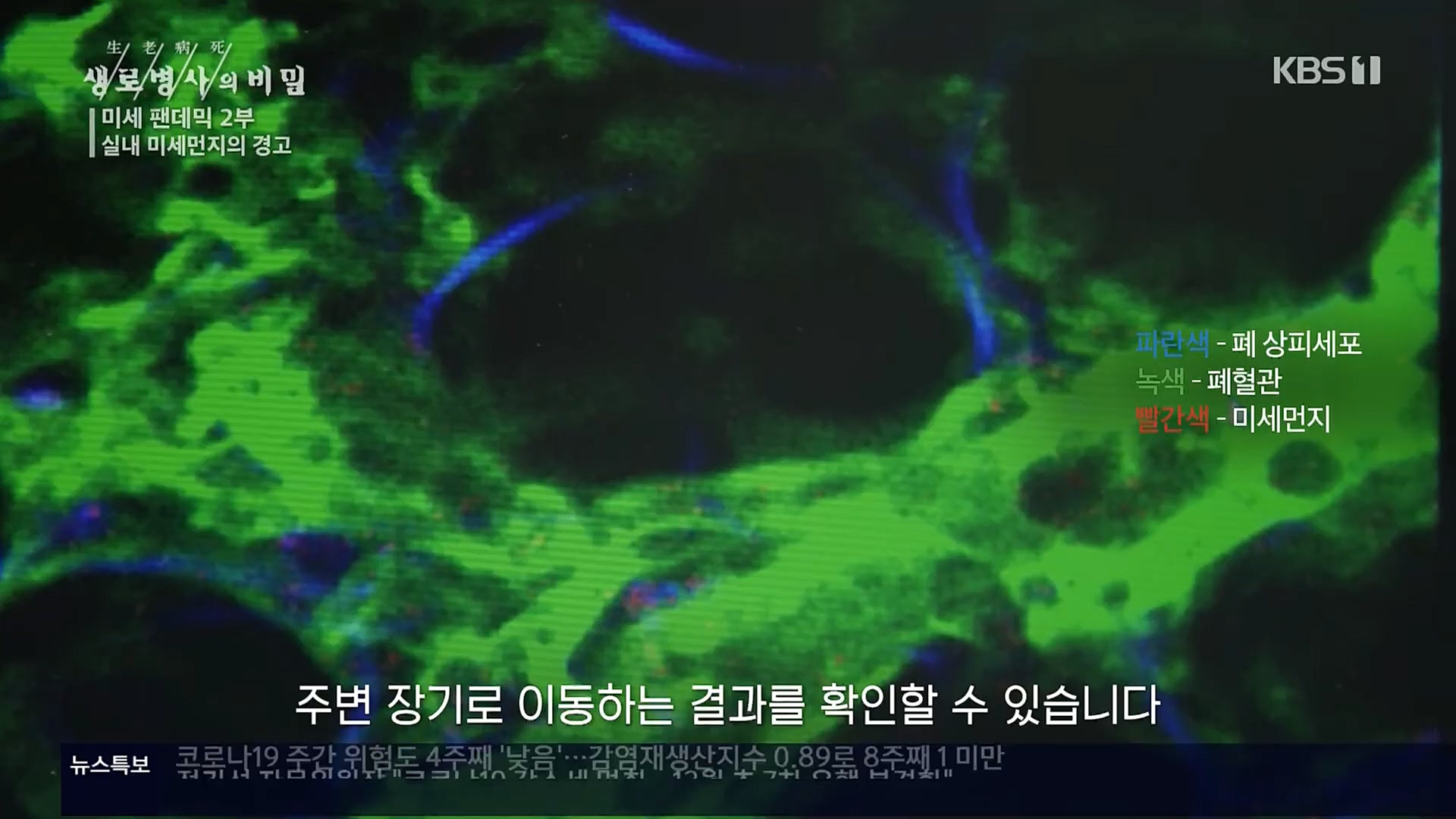 생로병사의 비밀.E840.221019p.H264-F1RST.mp4_20221020_180926.039.jpg