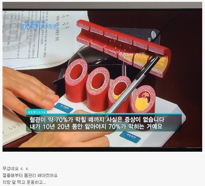  혈관 질환이 무서운 이유