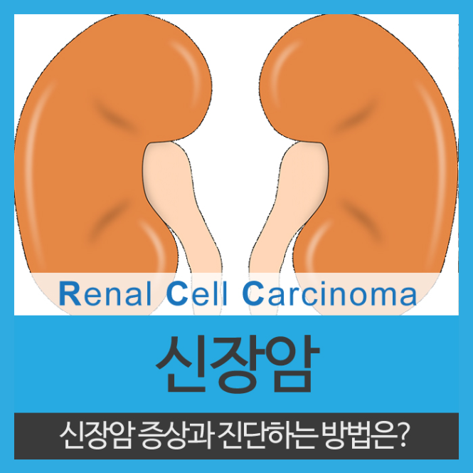  신장암 증상, 진단하는 방법 기억해 두셔야해요