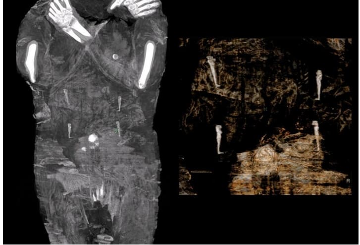 세계 최초 임신 미이라 공개 VIDEO: A Closer Look at the World&#39;s First Pregnant Egyptian Mummy