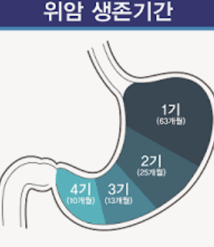 위암 4기 생존율