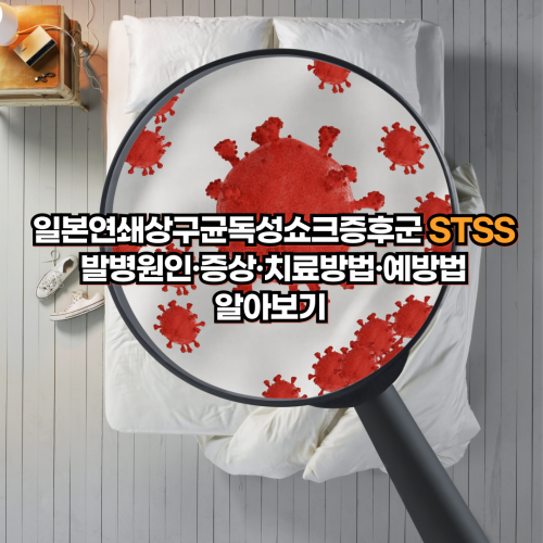  일본연쇄상구균독성쇼크증후군 STSS 발병원인·증상·치료방법·예방법 알아보기