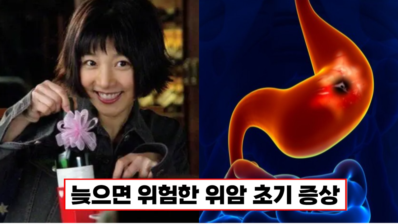 "배우 장진영 37세에 위암 사망" 안타까웠던 당시 증상은?