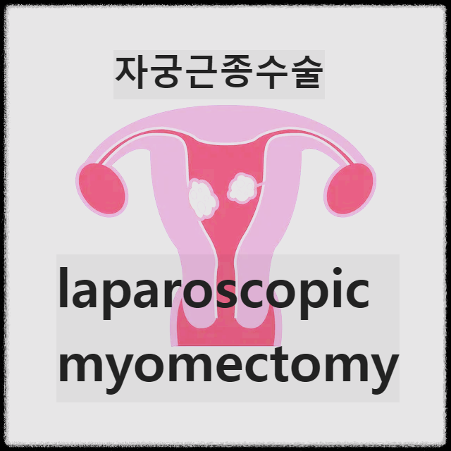  laparoscopic myomectomy 복강경 근종 절제술 수술과정