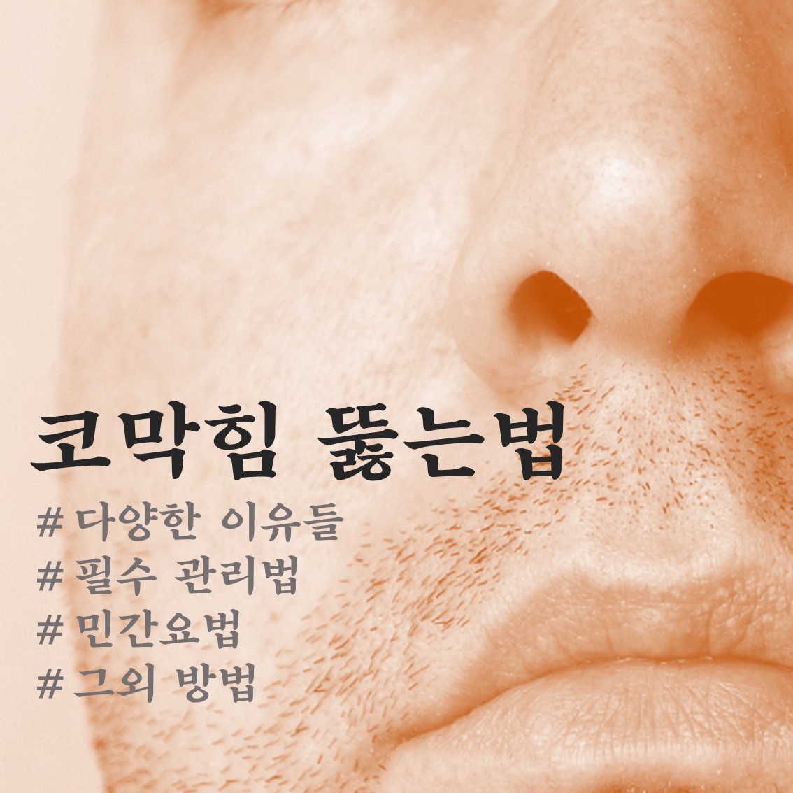 비염의 원인 파악과 코막힘 구멍 뚫는 방법