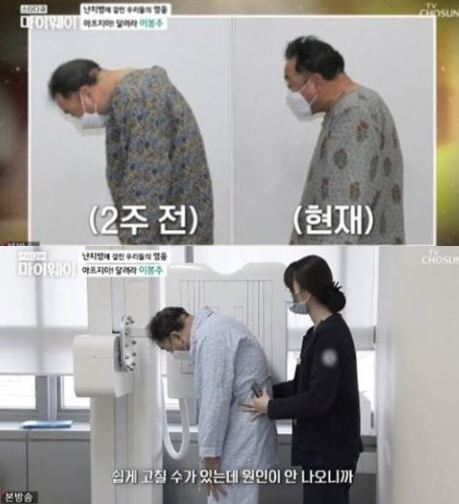 이봉주-난치병-근육긴장이상증