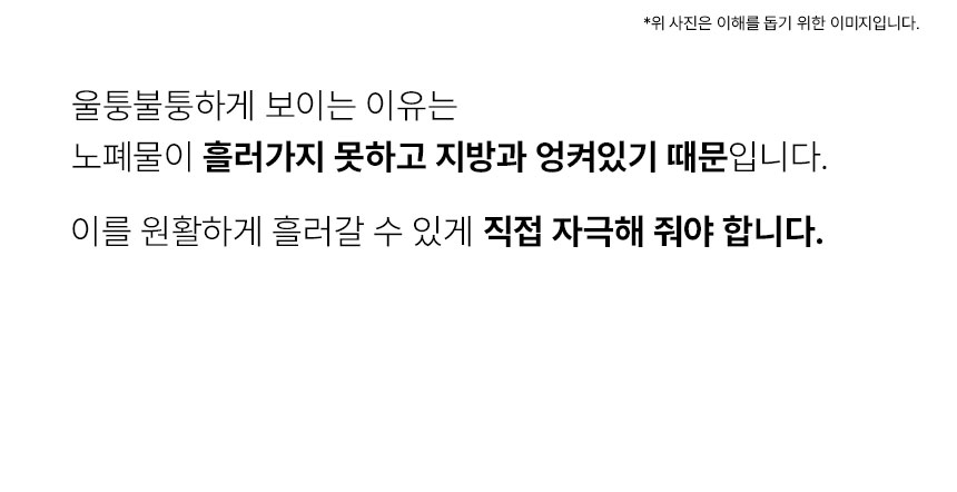 울퉁불퉁한하체3