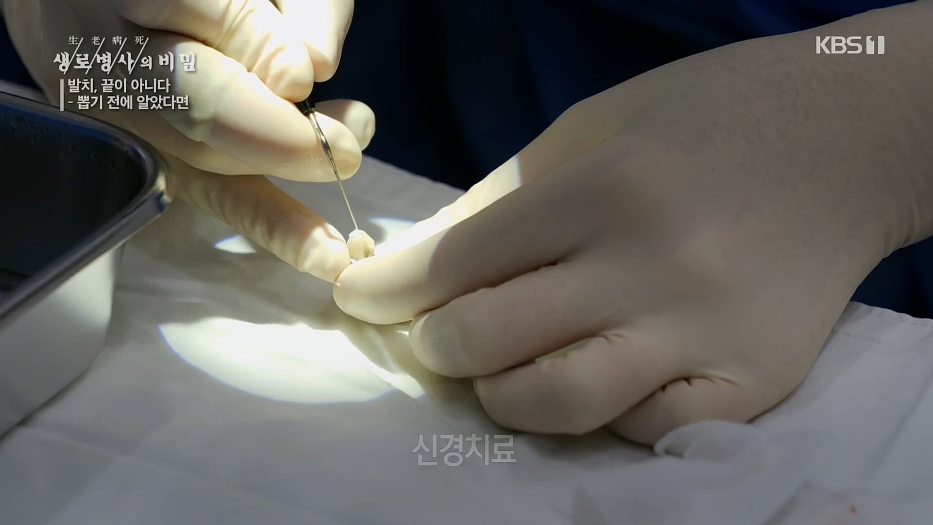 생로병사의 비밀.E855.230208p.H264-F1RST.mp4_20230214_194924.164.jpg