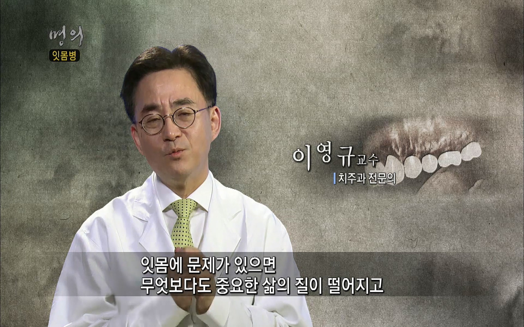 EBS 명의 헬스케어 - TV - 교육의 중심 EBS2015년 1월 16일 (금) 밤 9시 50분, EBS1.mp4_20220505_150417.025.jpg