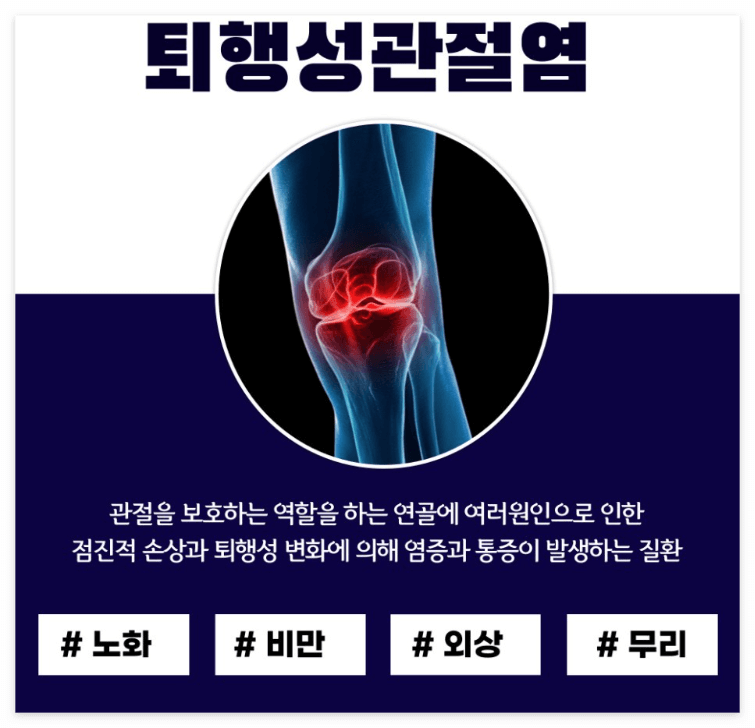  퇴행성 관절염의 관리와 치료법