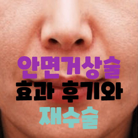 얼굴 주름이 심해 안면거상술이 필요한 여성의 사진